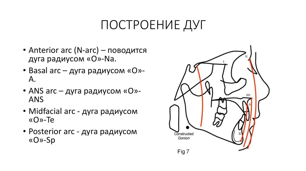 ПОСТРОЕНИЕ ДУГ