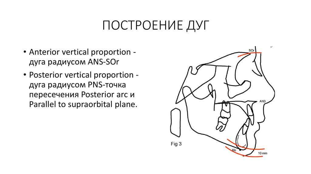 ПОСТРОЕНИЕ ДУГ