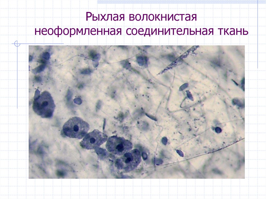 Рыхлая волокнистая неоформленная соединительная ткань рисунок