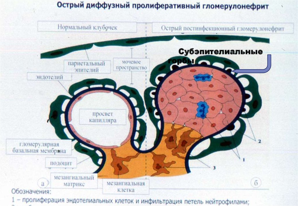 Гломерулонефрит казакша презентация