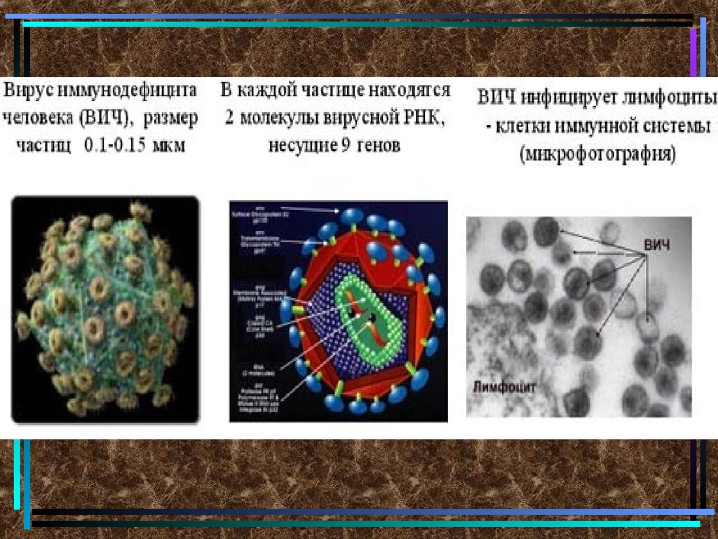 Вич название вируса. Вирус СПИДА. Размеры вирусных частиц. Вирус иммунодефицита. Размер вируса ВИЧ.