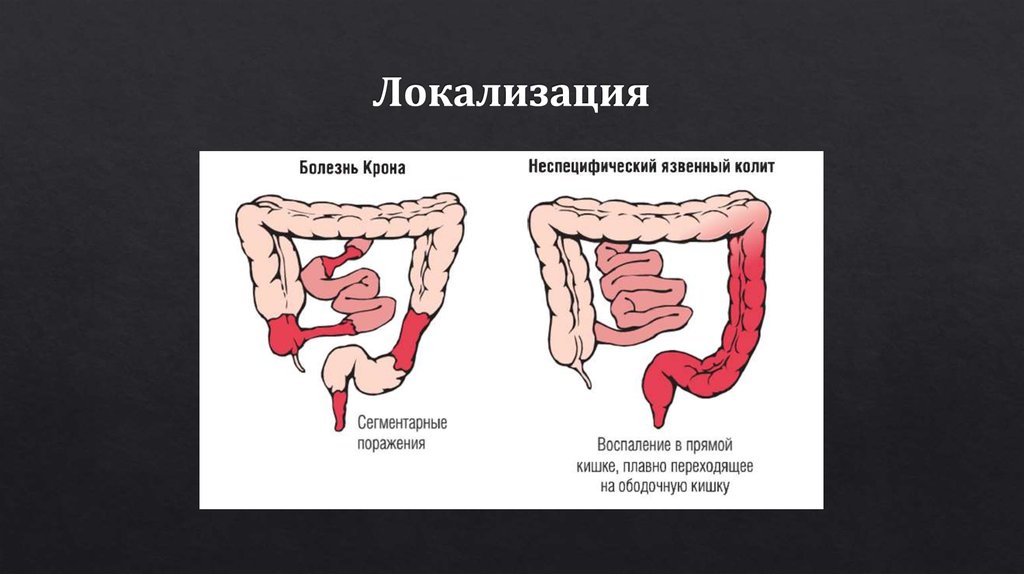 Локализация