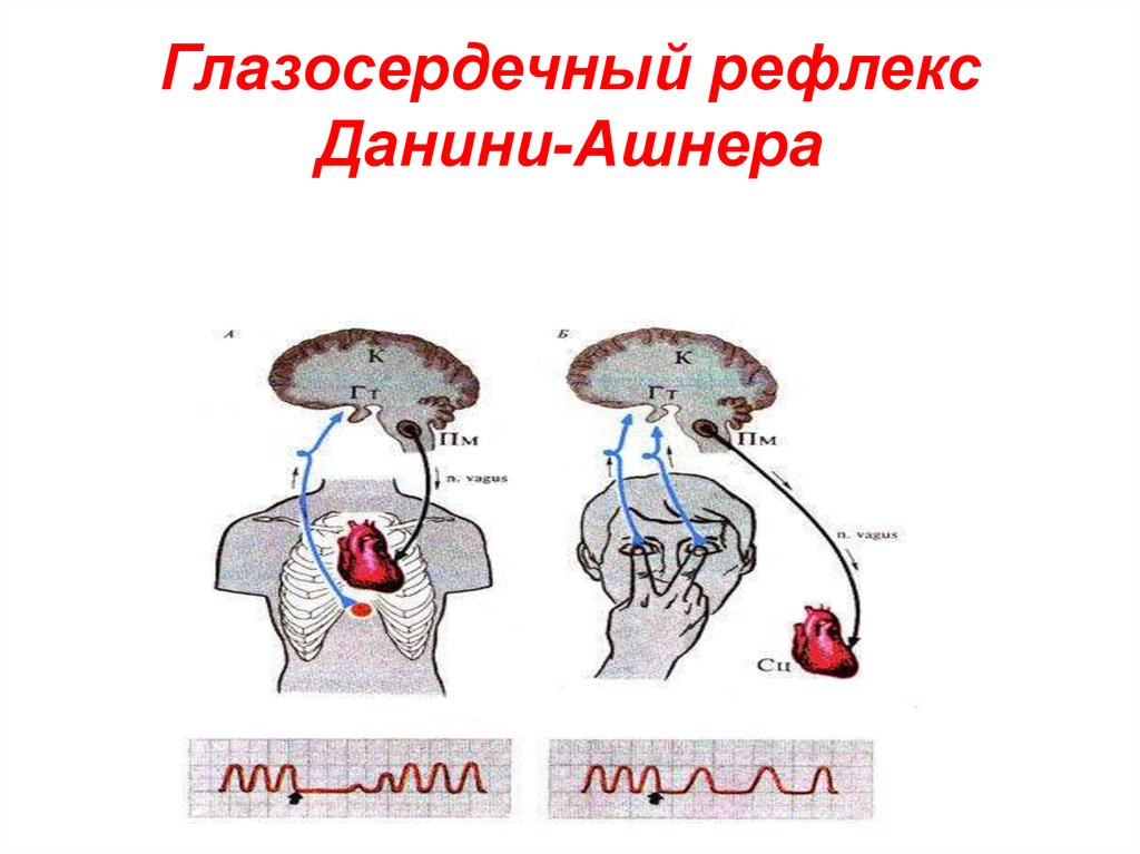 Глазосердечный рефлекс физиология схема