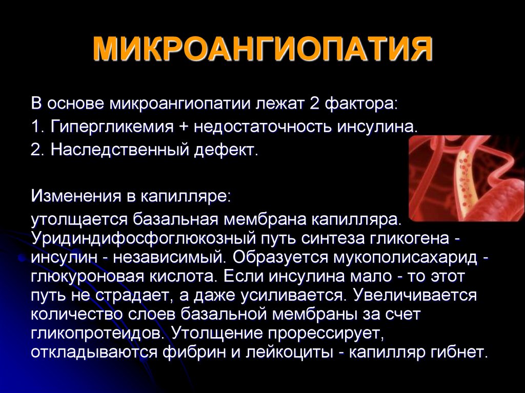 Микроангиопатия мозга