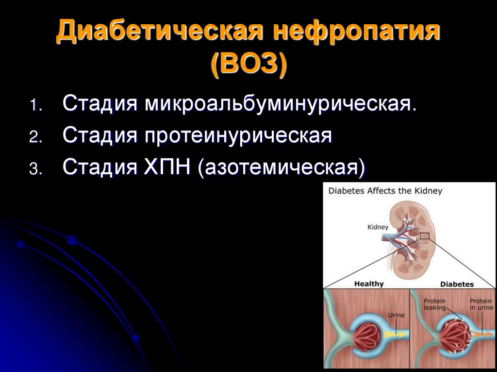 Диабетическая нефропатия презентация