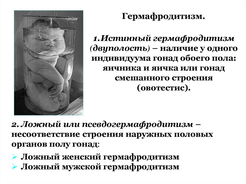 Гермафродит фото половых органов