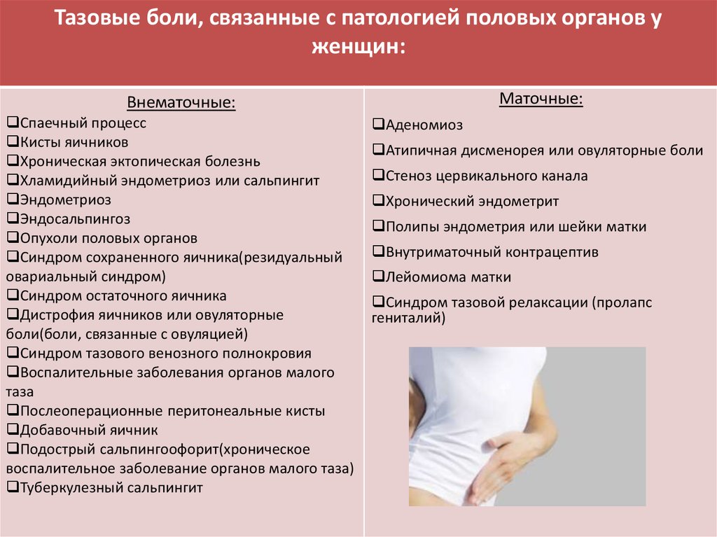 Поясница беременность форум. Причины хронической тазовой боли у женщин. Синдром тазовой боли у женщин. Синдром хронической тазовой боли у женщин.