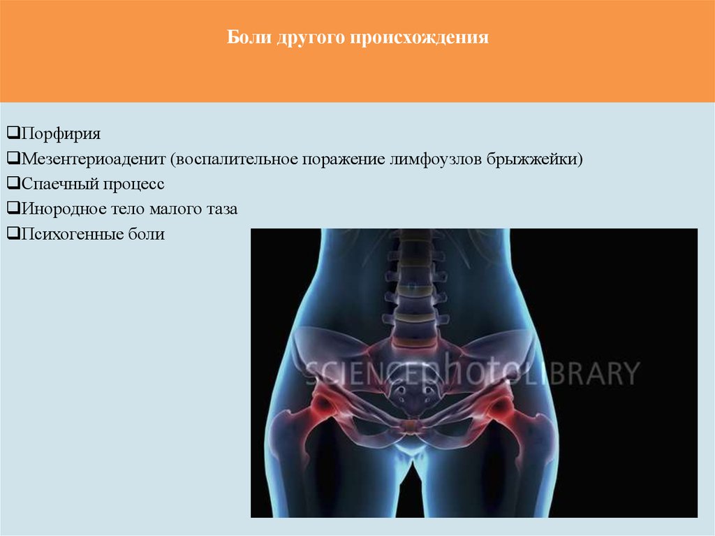 Боль в тазу. Боль в области малого таза. Заболевания таза у женщин. Боль в Малом тазу у женщин.