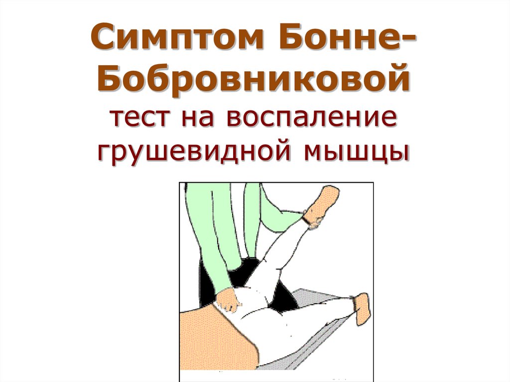 Симптом грушевидной мышцы. Симптом натяжения Бонне. Симптом Бонне Бобровниковой. Тест на грушевидную мышцу.