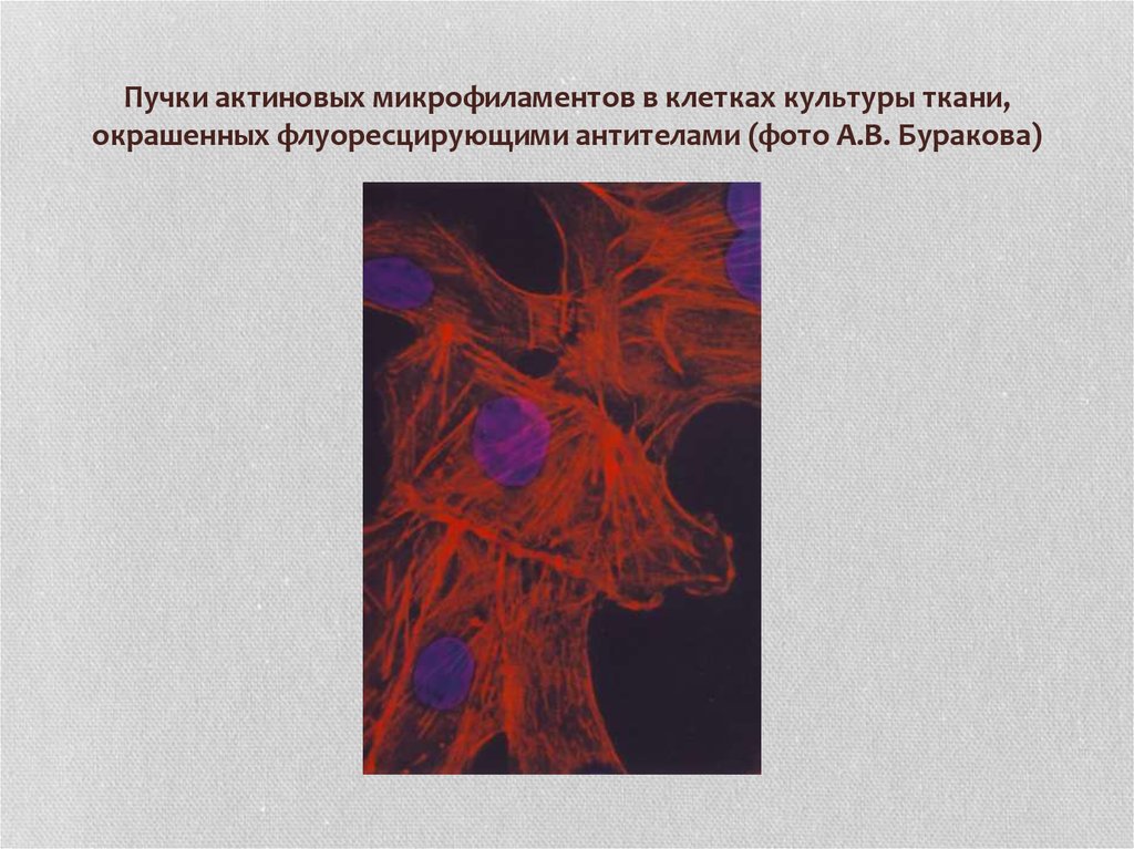 Пучки актиновых микрофиламентов в клетках культуры ткани, окрашенных флуоресцирующими антителами (фото А.В. Буракова)