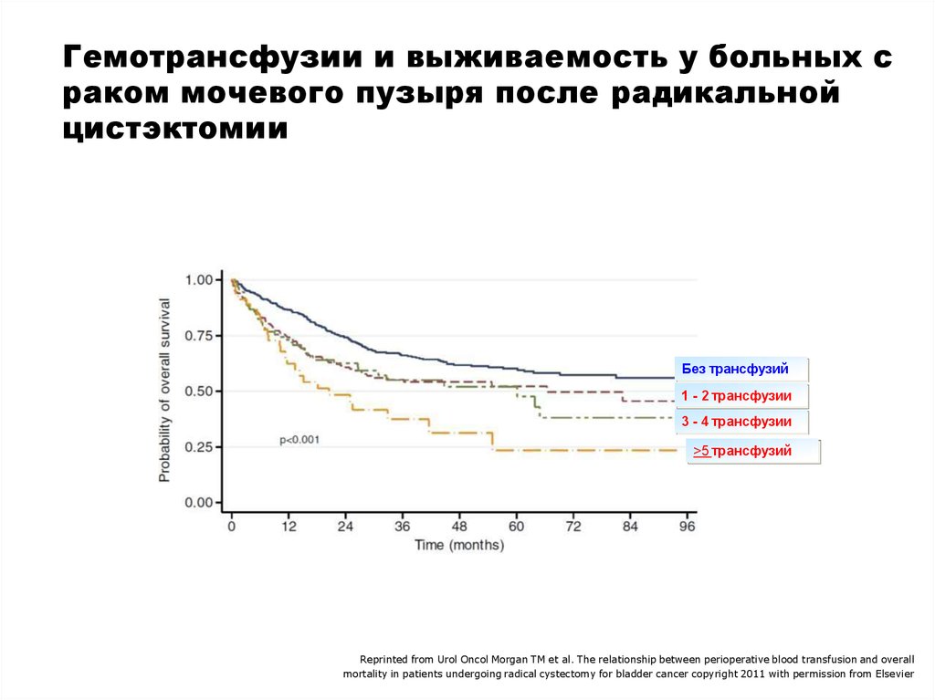 Гемотрансфузии и выживаемость у больных с раком мочевого пузыря после радикальной цистэктомии