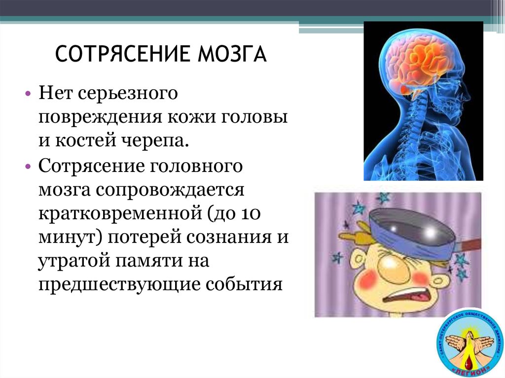 Симптомы сотрясение головного мозга взрослого и лечение