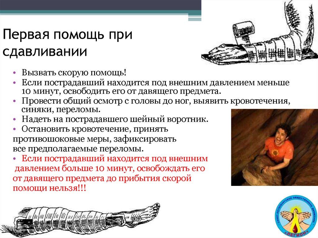 Под внешним. Первая помощь при сдавливании. Первая помощь при сдавливании конечностей. Первая помощь при сдавлении конечностей тяжелым предметом. Меры первой помощи при сдавливании конечностей.