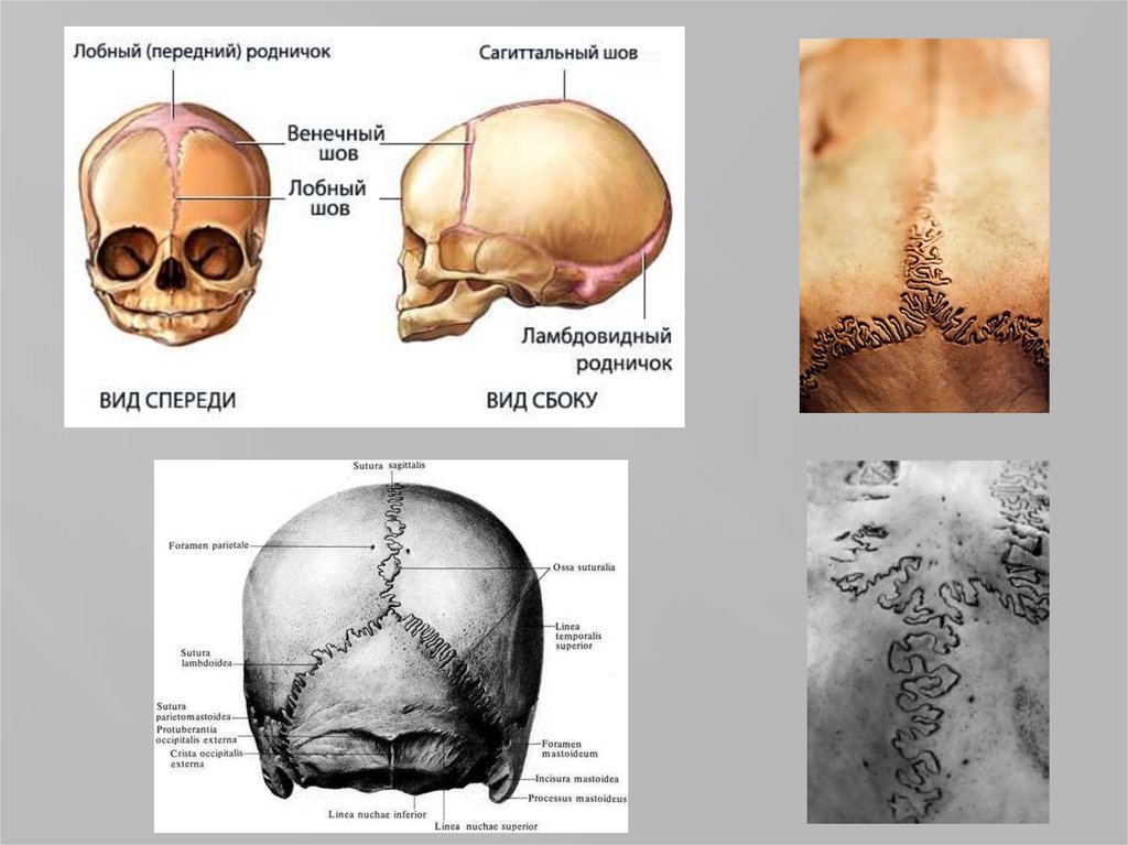 Лобные латынь. Швы черепа лобная кость. Швы черепа анатомия. Венечный Сагиттальный и ламбдовидный швы черепа.
