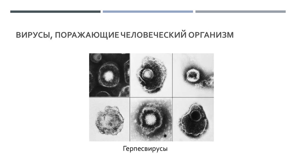 Вирусы, поражающие человеческий организм