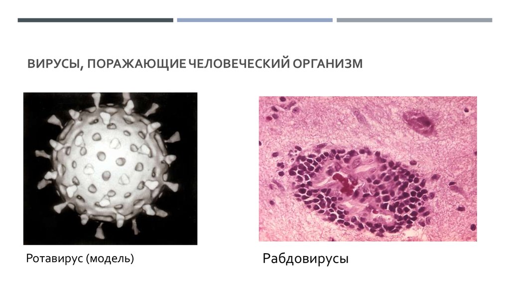   ВИРУСЫ, ПОРАЖАЮЩИЕ ЧЕЛОВЕЧЕСКИЙ ОРГАНИЗМ