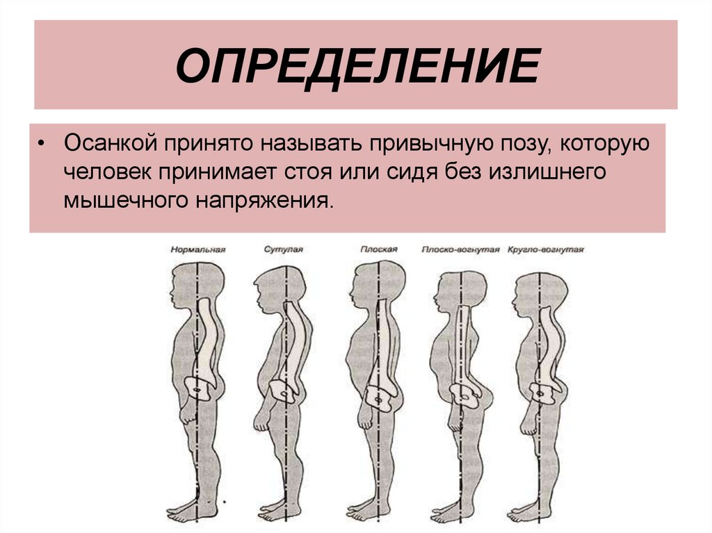 Практическая работа нарушение осанки и плоскостопие