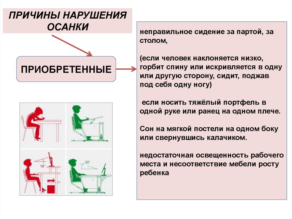 Главной причиной нарушения осанки является