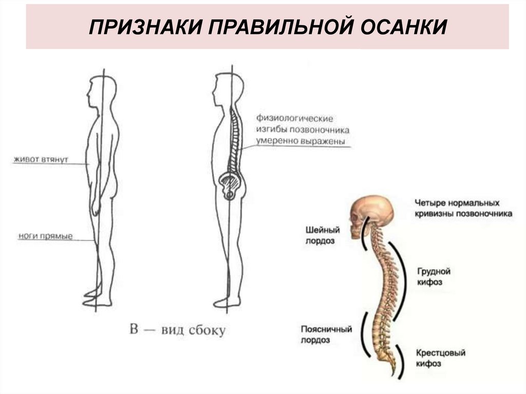 Признаки правильной осанки. Саркогине правильная.