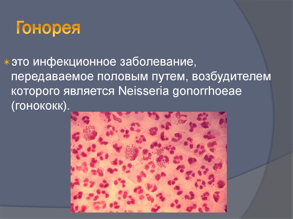 Гонококки хламидии. Нейссерия гонорея микробиология. Гонорея передается половым путем.