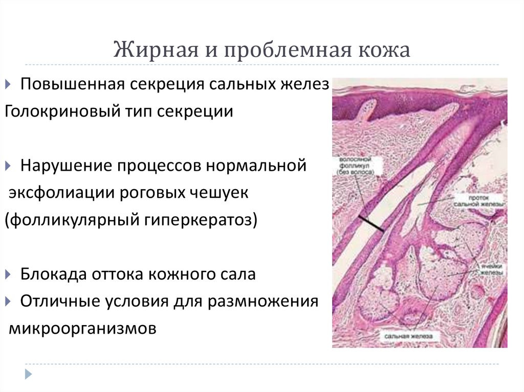 Печень сальные железы. Гиперплазия сальных желез. Гиперплазия сальной железы. Нормализация работы сальных желез.