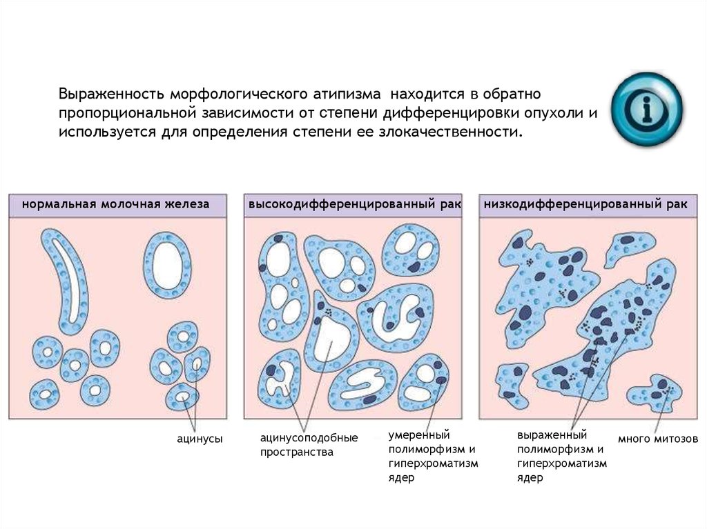 Виды опухолевого роста схема - 97 фото