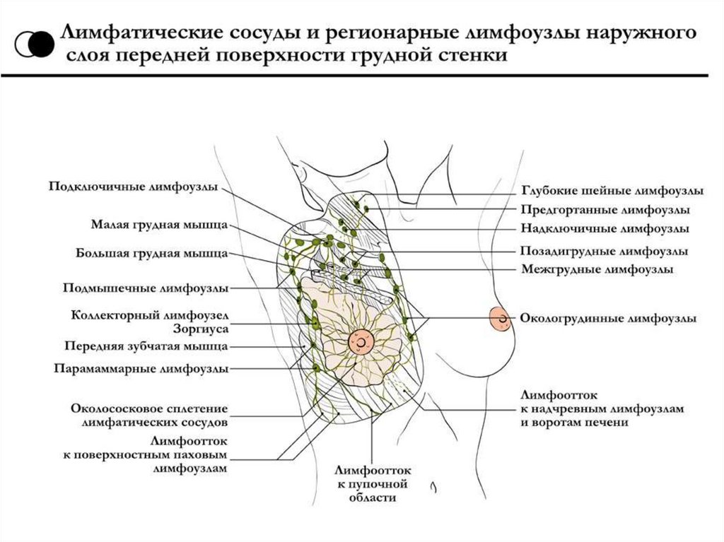 Фиброзные лимфоузлы. Лимфатическая система молочной железы анатомия. Подмышечные лимфоузлы схема расположение. Лимфатические узлы подключичной области топографическая анатомия. Лимфатические узлы грудной клетки схема.