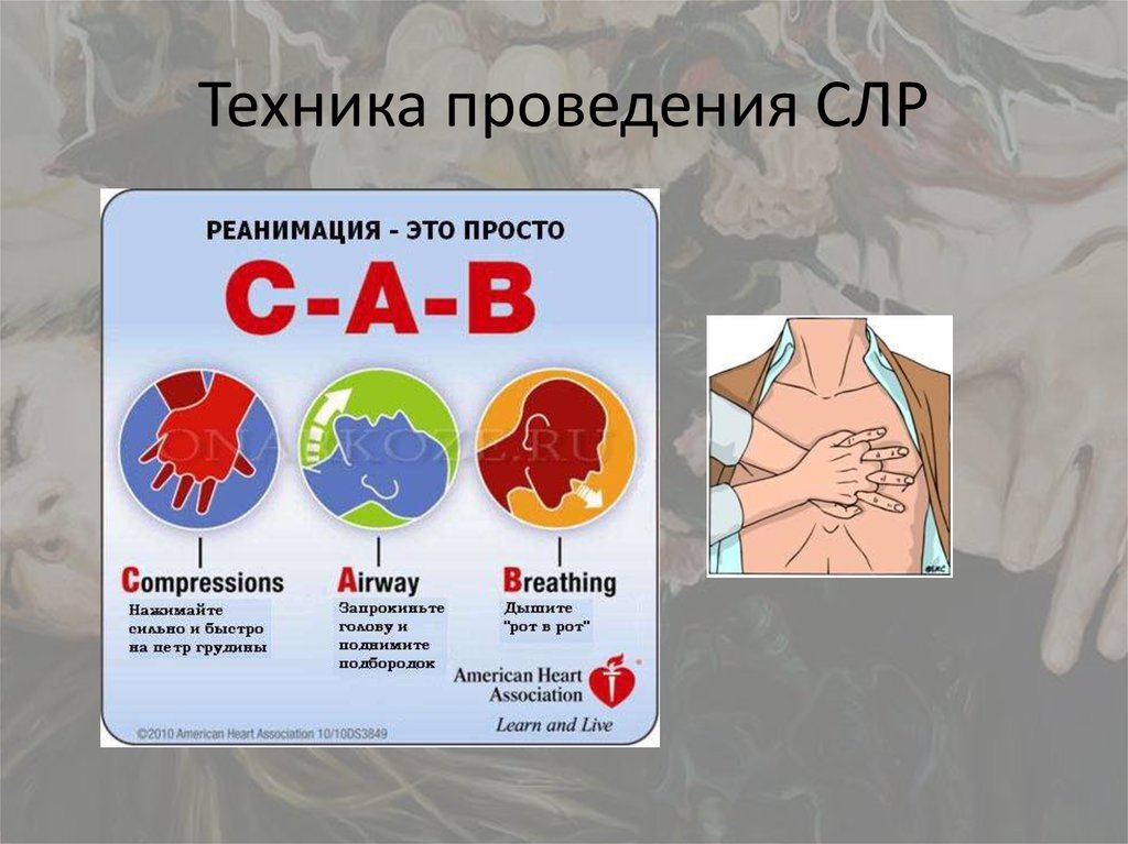 Проведении сердечно легочной реанимации соотношение