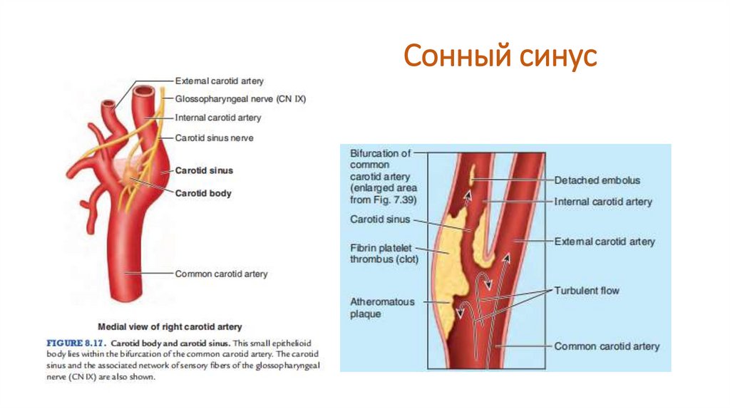 Составьте графологическую схему сонные артерии