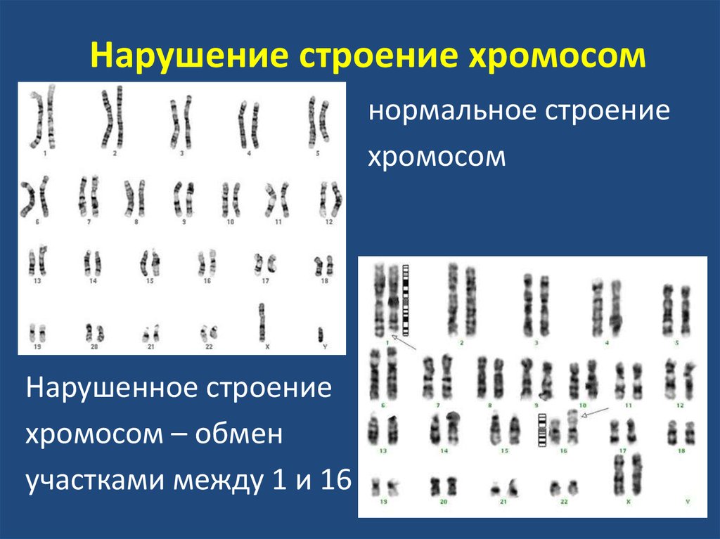 Цитогенетический кариотип