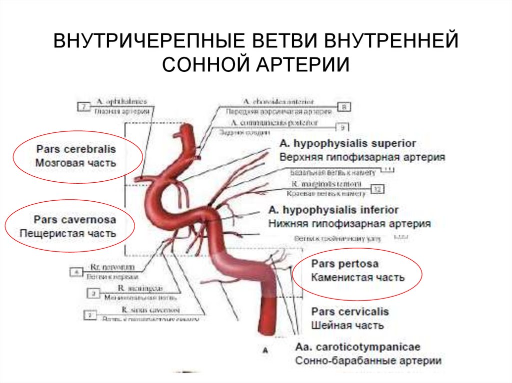 В статье под названием артерия жизни рассказывается. Внутренняя Сонная артерия анатомия схема ветви. Отделы внутренней сонной артерии схема. Отделы внутренней сонной артерии анатомия. Ветви внутренней сонной артерии.