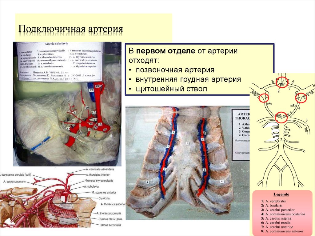 Сегмент v4 правой позвоночной артерии
