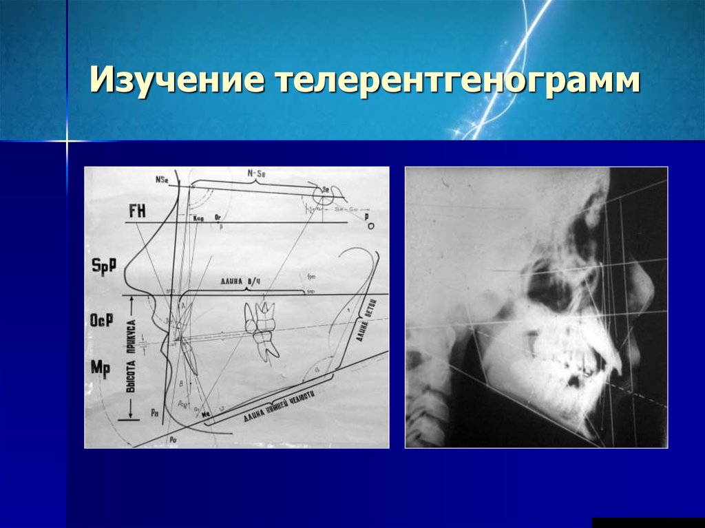 Функциональные методы диагностики в ортодонтии презентация