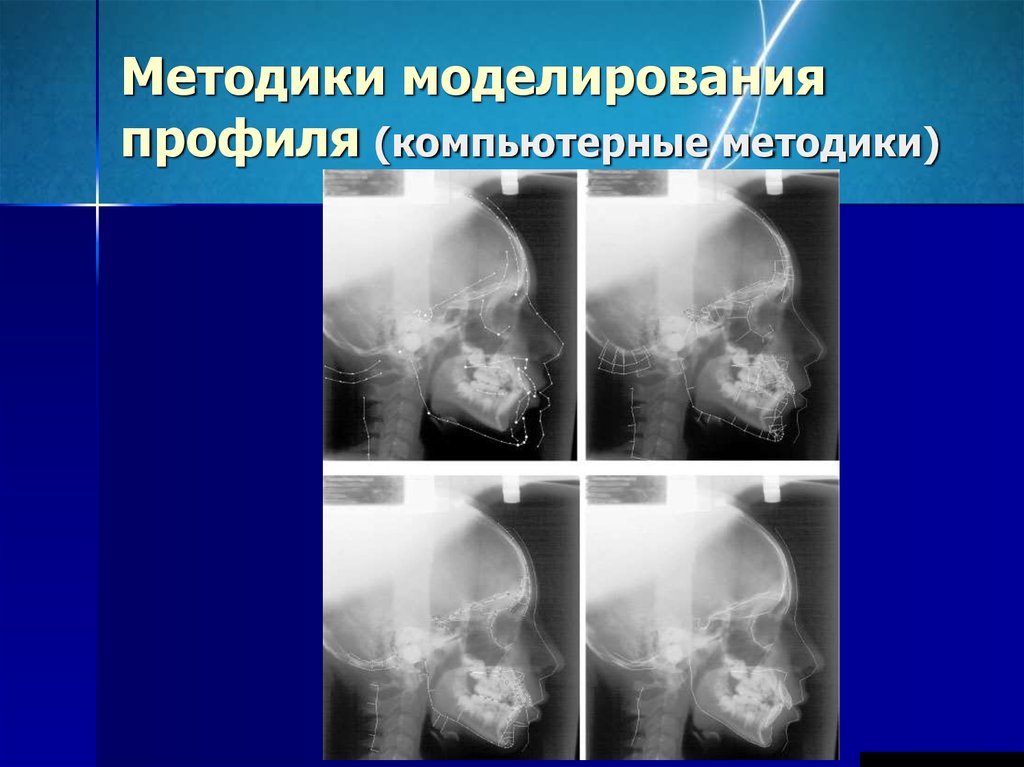 Функциональные методы диагностики в ортодонтии презентация