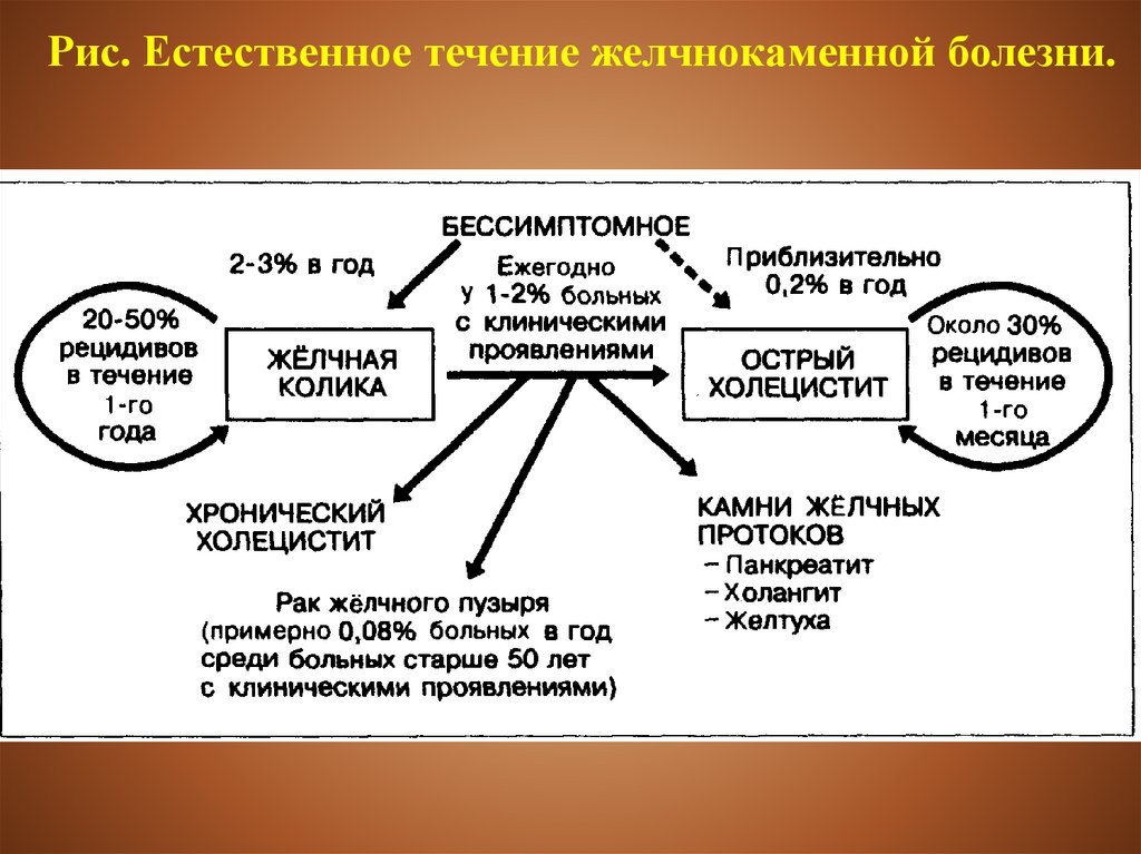 Естественное течение. Схема порочного круга при желчнокаменной болезни. Патогенез желчной колики. Желчная колика этиология. Естественное течение ЖКБ (появление симптомов и развитие осложнений).