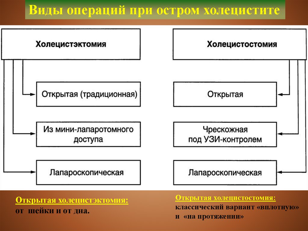 Хирургические операции по срокам выполнения схема