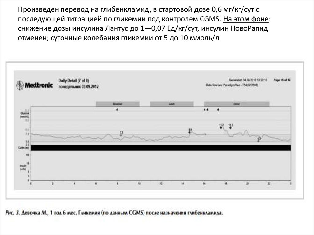 Произведен перевод на глибенкламид, в стартовой дозе 0,6 мг/кг/сут с последующей титрацией по гликемии под контролем CGMS. На