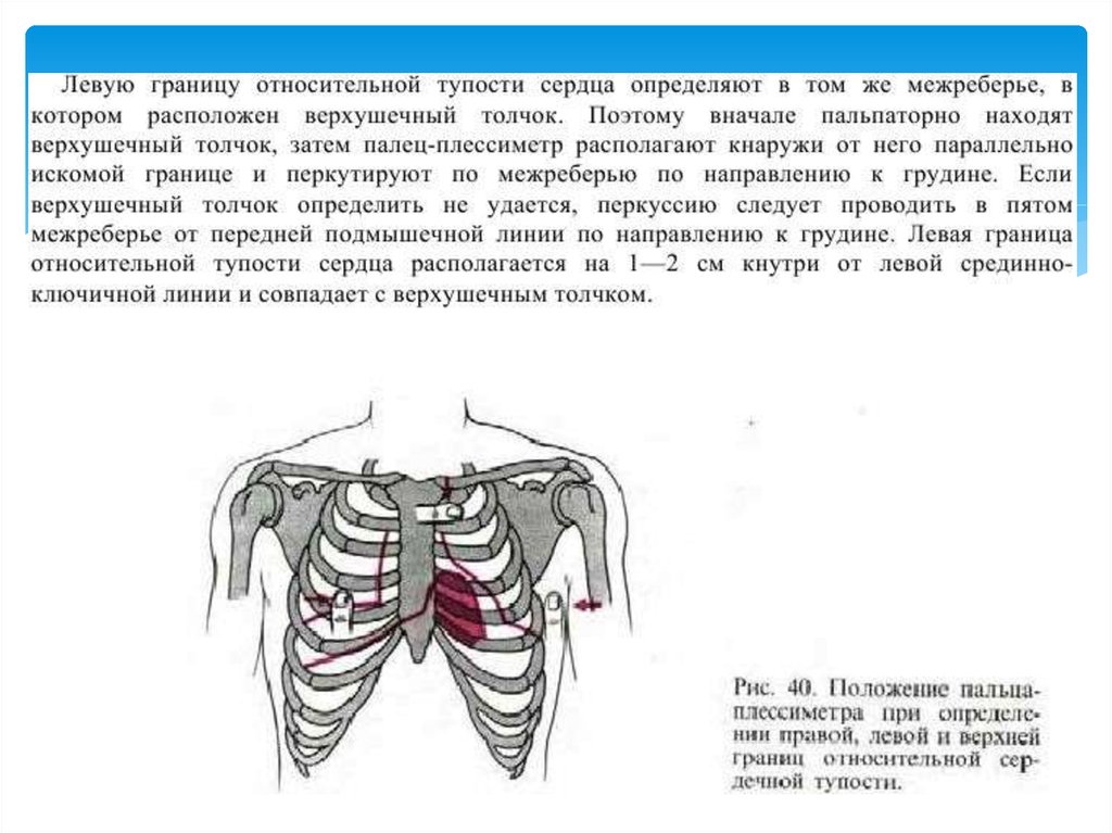 Границы сердечной тупости. Границы относительной сердечной тупости в норме и патологии. Правая граница относительной тупости сердца в 4 межреберье. Верхняя граница сердца находится. Левая граница относительной сердечной тупости.