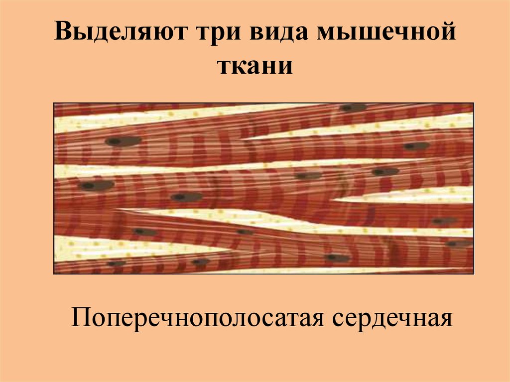 Какова особенность волокон поперечнополосатой мышечной ткани. Поперечнополосатая сердечная мышечная ткань. Строение мышечной ткани. Мышечная ткань рыбы.