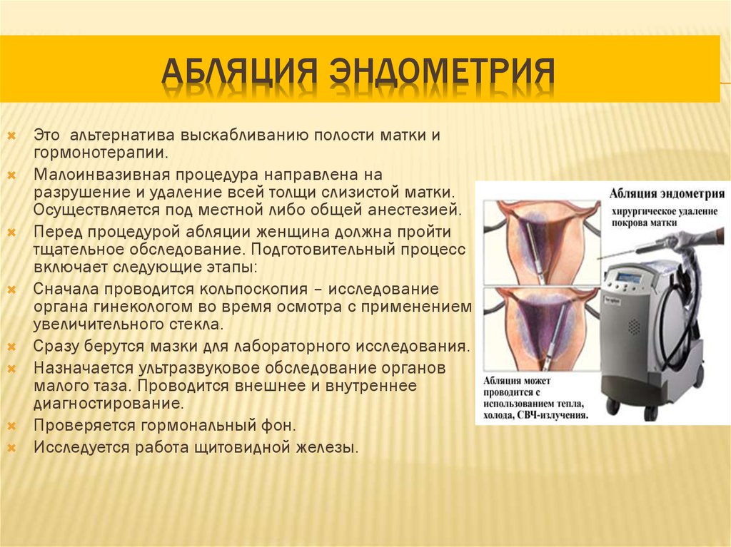 Операция по удалению эндометрия матки. Аблацией эндометрия. Электрохирургическая аблация эндометрия. Абляция (резекция) эндометрия.