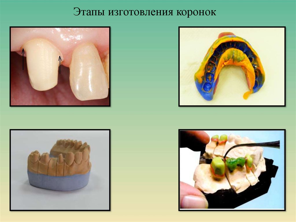 Презентация вкладки в стоматологии