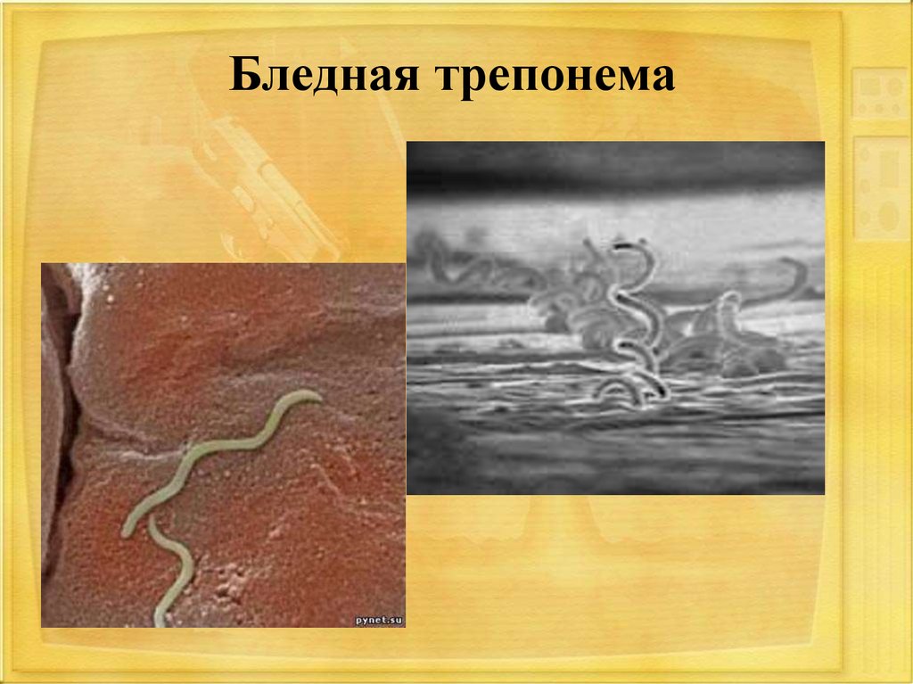 Бледная трепонема treponema pallidum. Бледная трепонема спирохетты. Бледная спирохета это паразит. Трепонема паллидум вызывает.