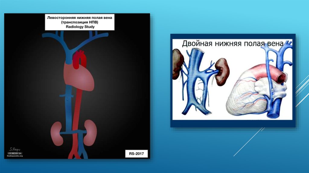 Развитие вен презентация