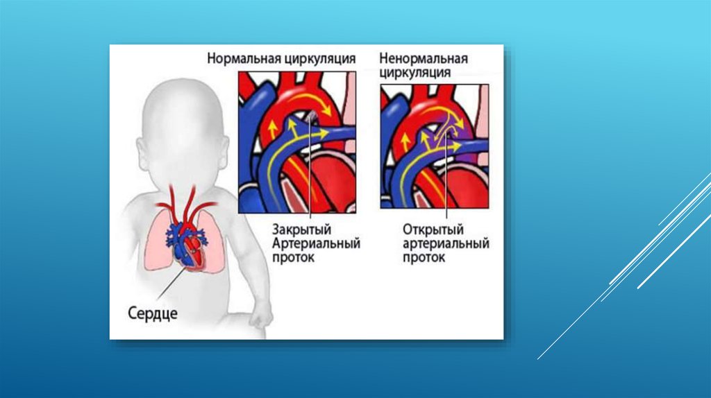 Развитие вен презентация