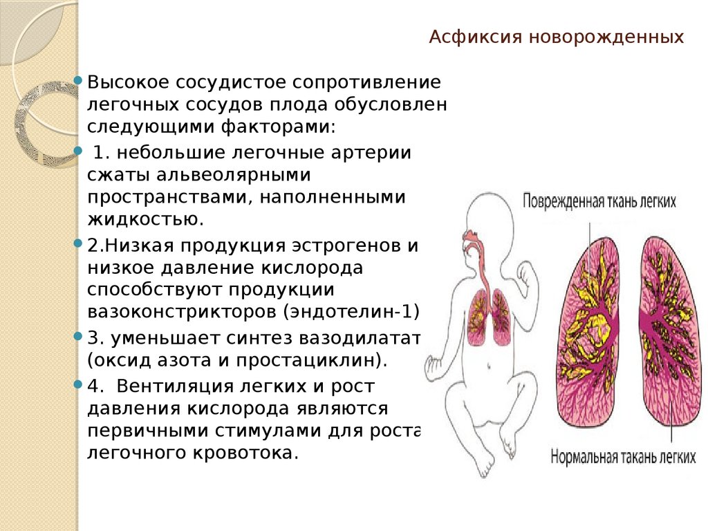 Причины асфиксии. Асфиксия новорождённых. Легочные причины асфиксии.