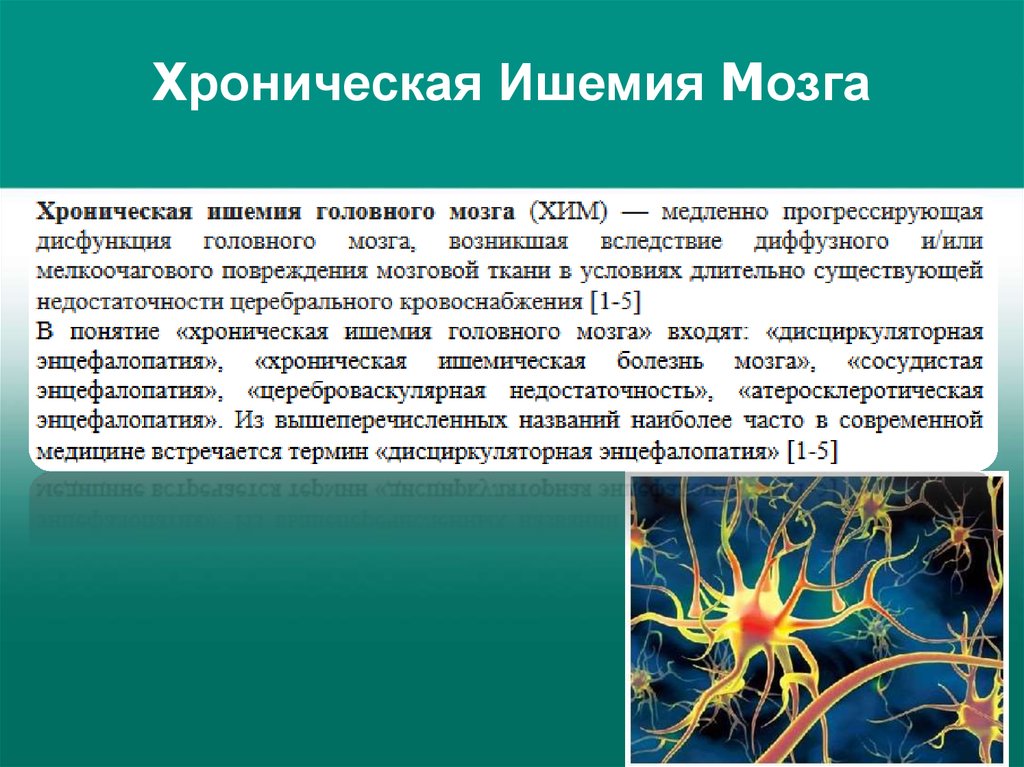 Ишемия головы. Ишемическая болезнь мозга 2 степени. Хроническая ишемия головного мозга. Шинамия головного мозга. Хроническая ишемия головного мозга 2.