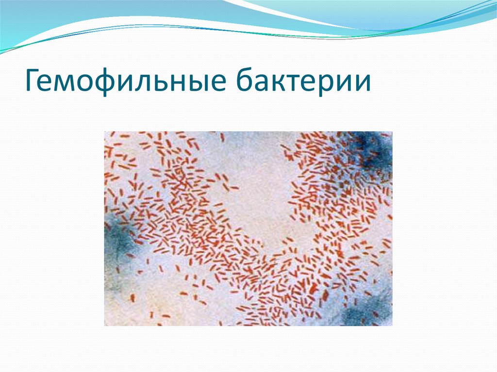 Haemophilus influenzae b. Haemophilus influenzae возбудитель. Гемофильная палочка микробиология. Гемофильная палочка микробиология морфология. Haemophilus influenzae микробиология.