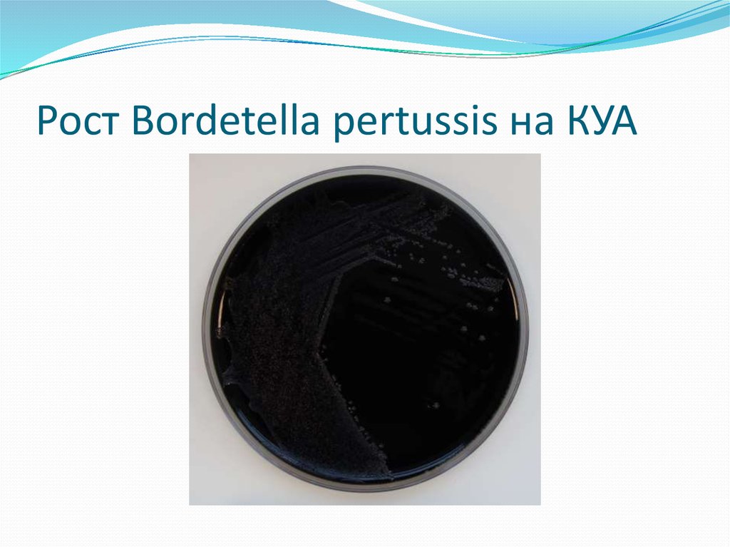 Бордетелла пертусис. Bordetella pertussis на казеиново-угольном агаре. Казеиново угольный агар для коклюша. Бордетеллы на казеиново-угольном агаре. Среда Куа казеиново-угольный агар.