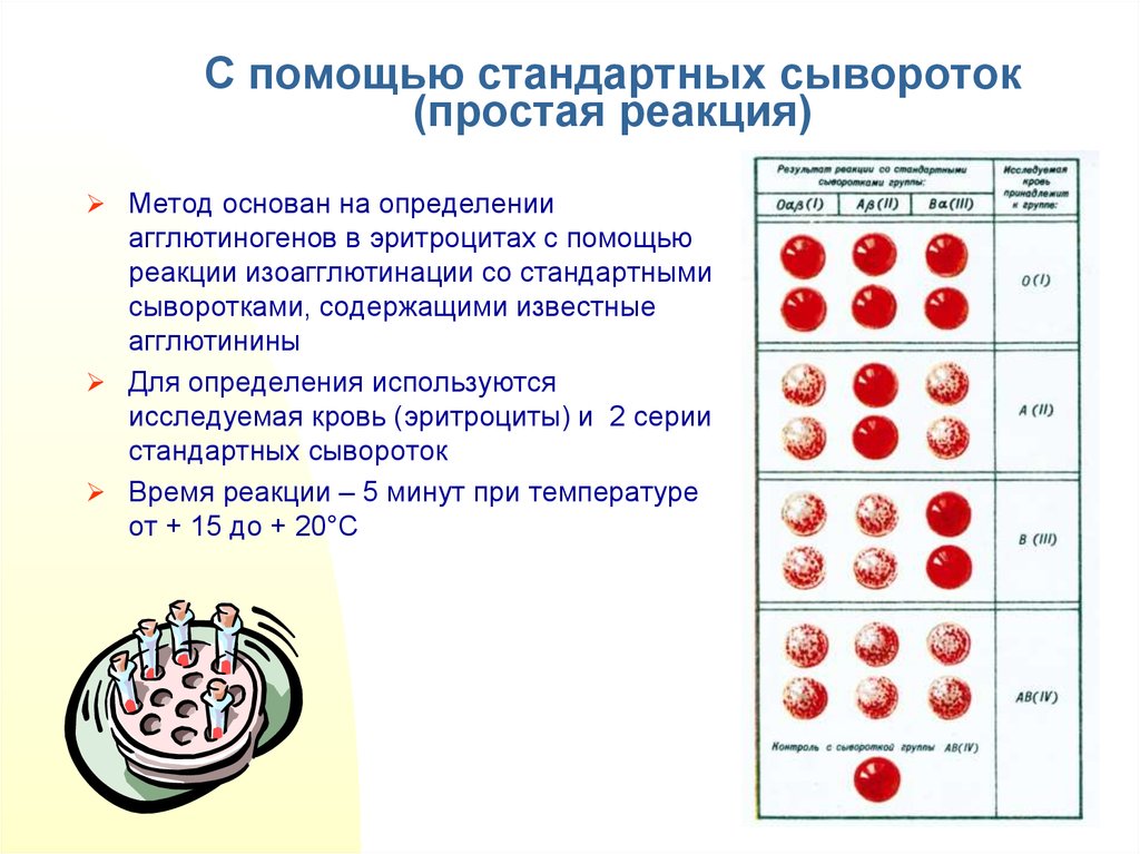 Результаты определения группы крови. Определение группы крови стандартными сыворотками. Метод стандартных изогемагглютинирующих сывороток. Определить группу крови с помощью стандартных сывороток. * Алгоритм группа крови с сывороткой.