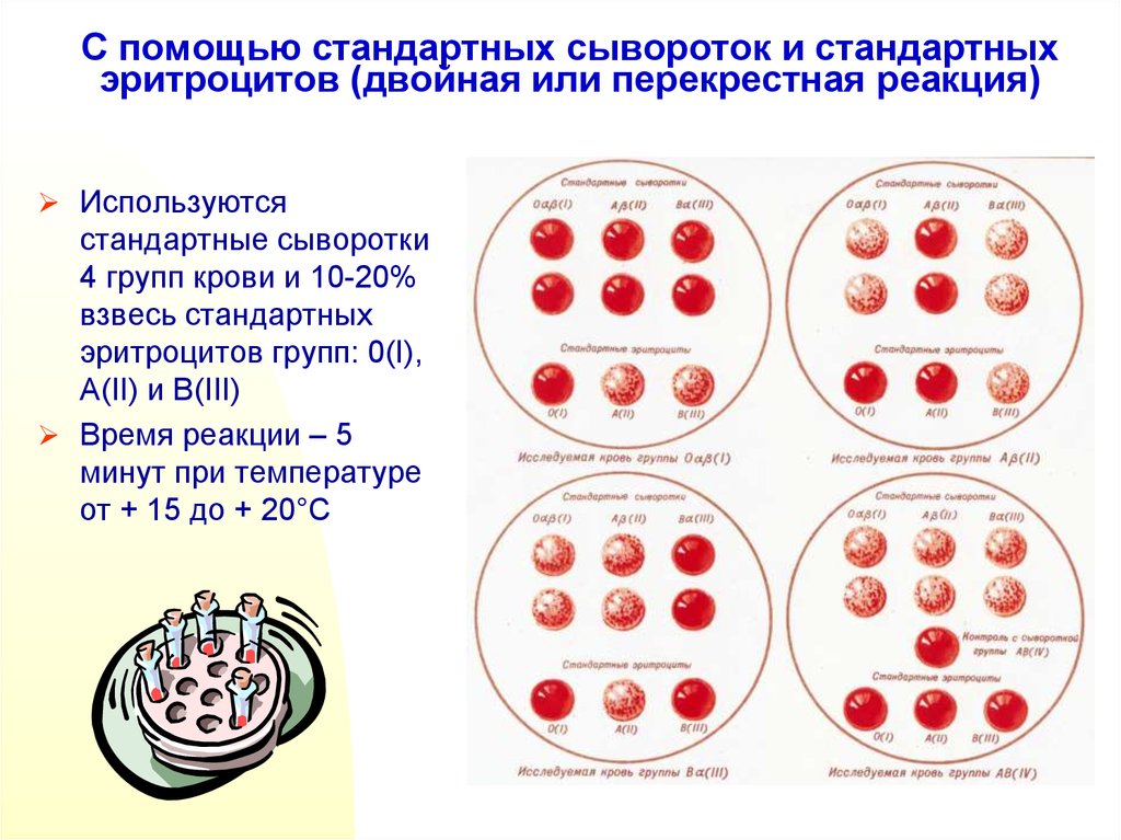 Результаты определения группы крови. Группа крови стандартные эритроциты. Группы крови стандартными сыворотками. Определить группу крови с помощью стандартных сывороток. Определение группы крови цоликлонами схема.
